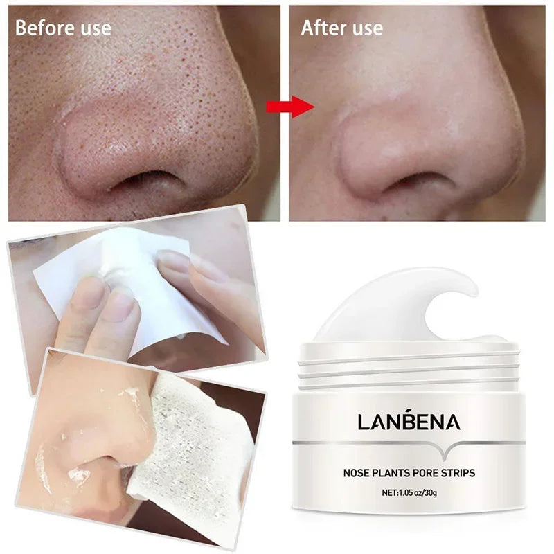 Plant based anti-pore nose strips